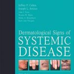 Dermatological Signs of Systemic Disease